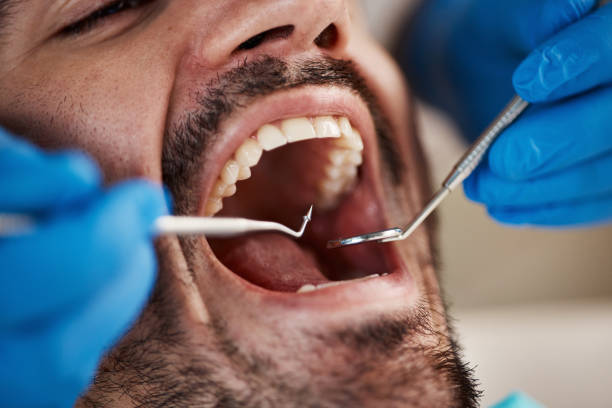 Best Emergency Tooth Extraction in Norwood, NC