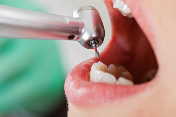 Best Same-Day Emergency Dental Services in Norwood, NC